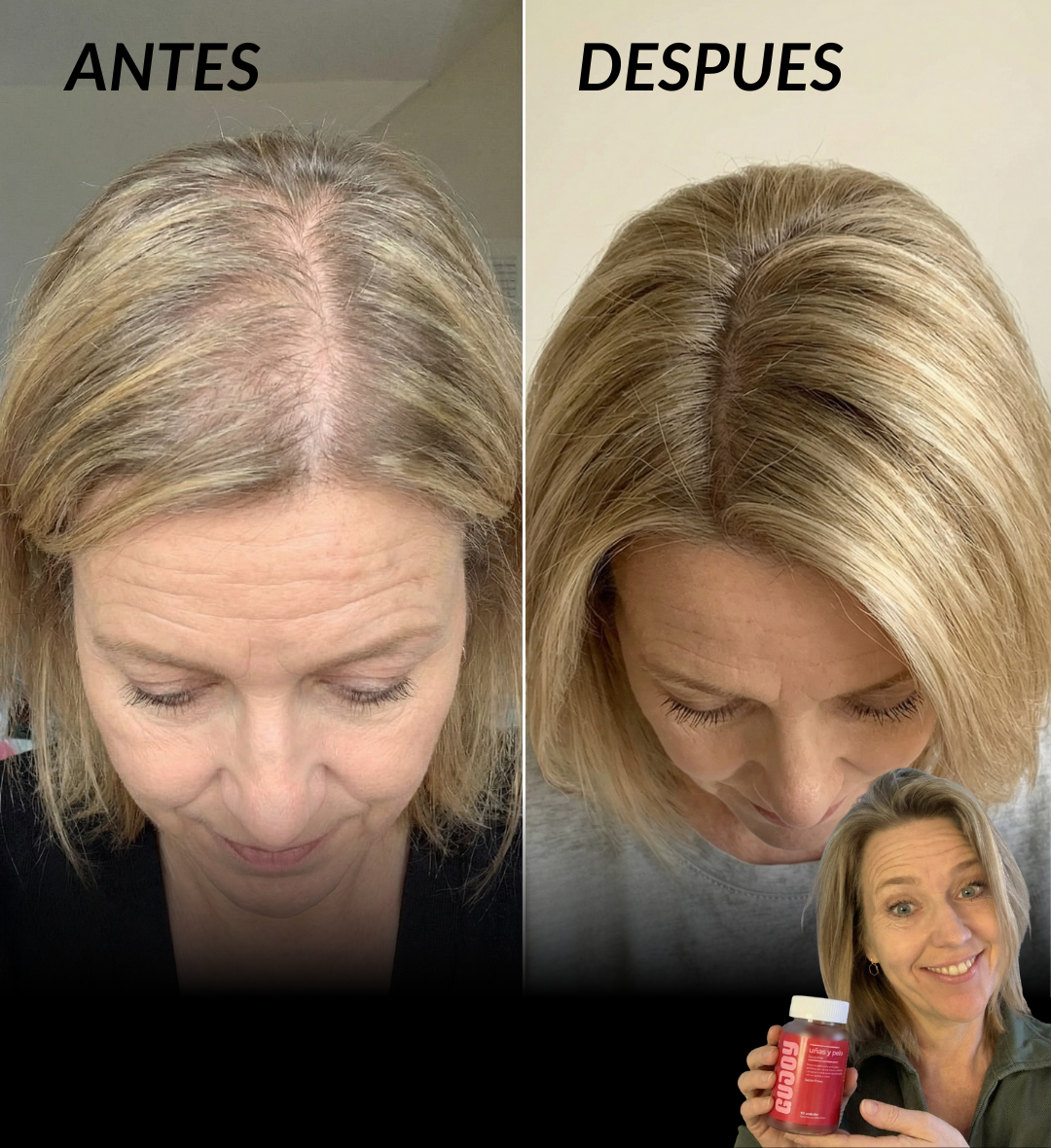 Gummies Pelo Y Uñas