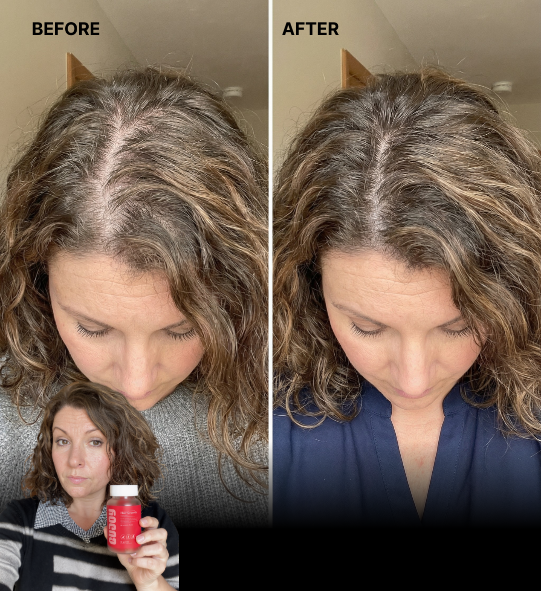 Hair Growth Gummies