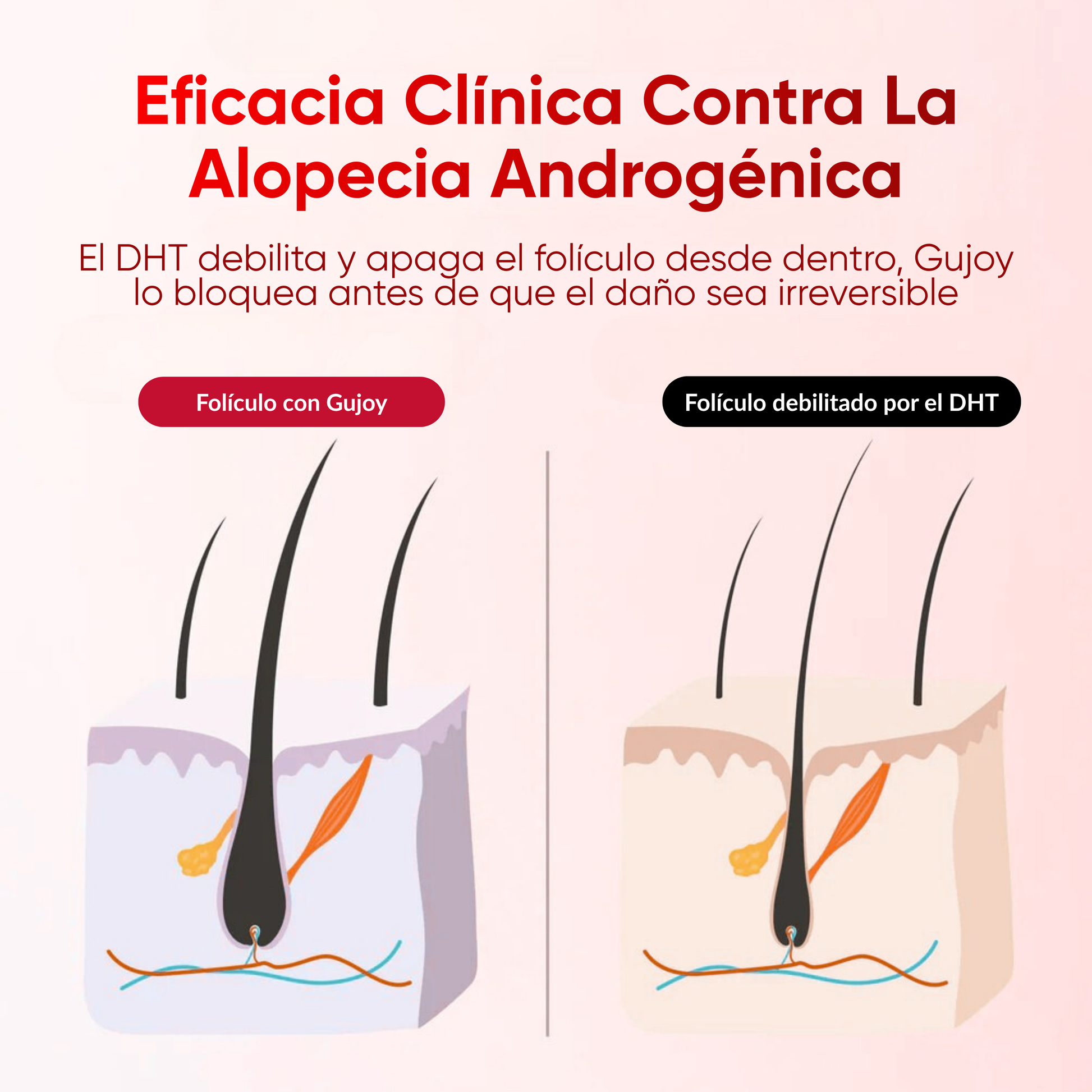 Gominolas para Alopecia