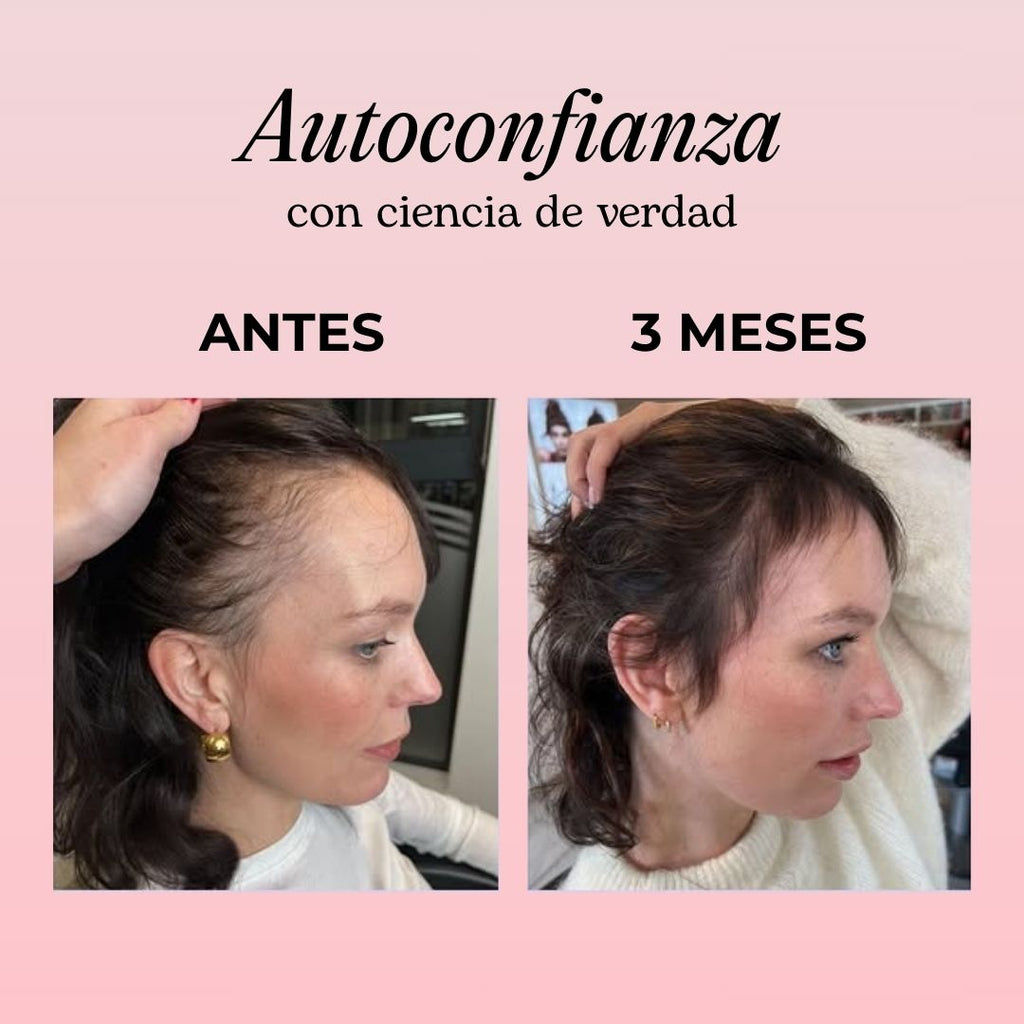 3x Gummies Para Pelo Y Uñas