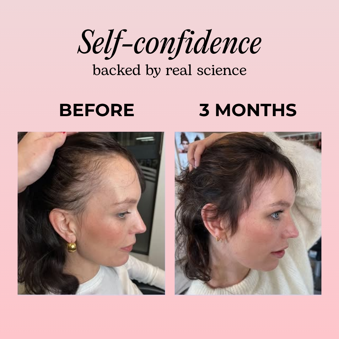 Gujoy Hair Growth 